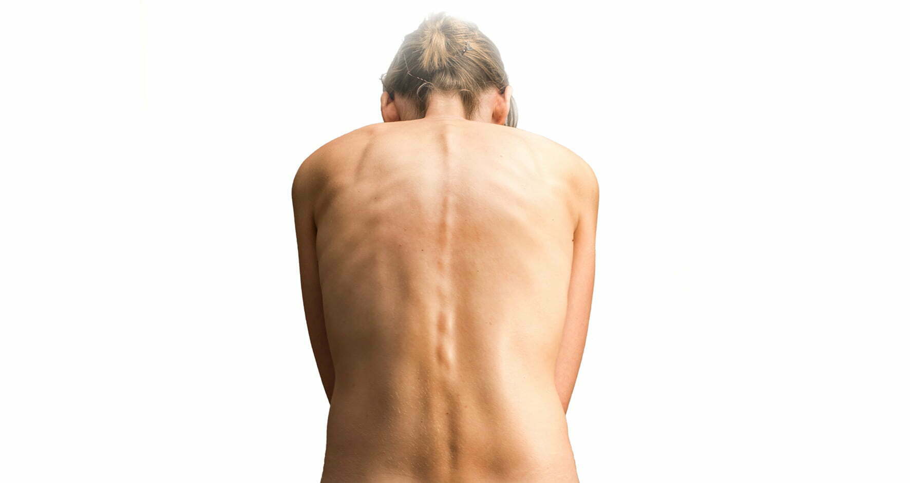 Can Scoliosis Lead to Cancer?